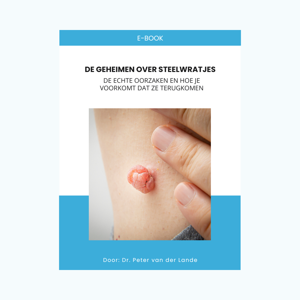 E-book | De geheimen over steelwratjes