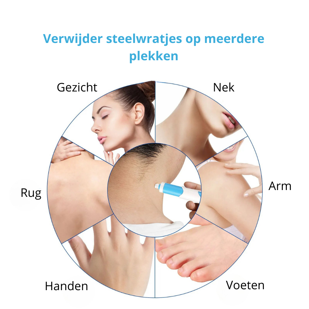 TagFree™ Kit | Voor iedereen die zich onzeker voelt over steelwratjes