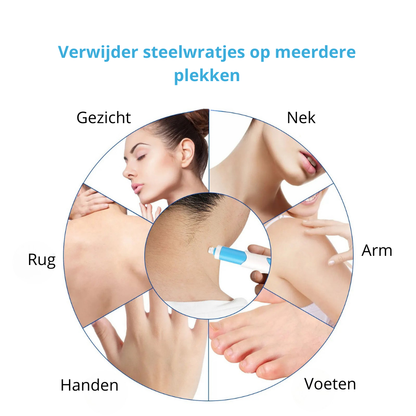 TagFree™ Kit | Voor iedereen die zich onzeker voelt over steelwratjes