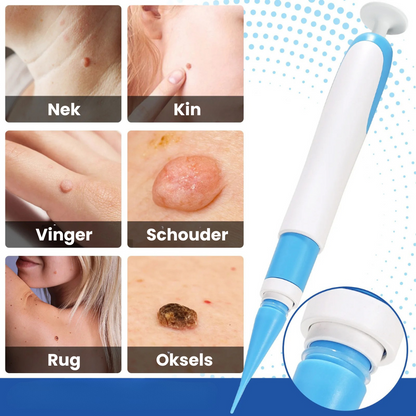 TagPen™ Go Kit | Binnen 5 tot 10 dagen van steelwratjes af | 50% korting