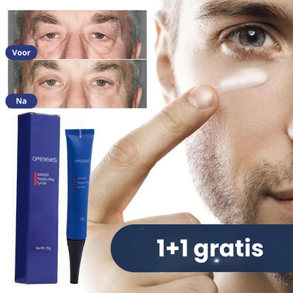 OpenEyes™ | Frisse, uitgeruste ogen in 30 seconden per dag | 1+1 gratis