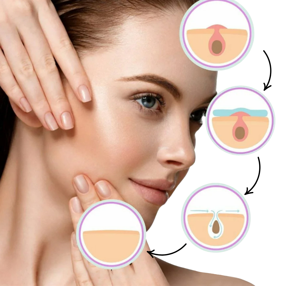 TagPatch™ | Verwijder makkelijk steelwratjes vanuit huis | 50% korting