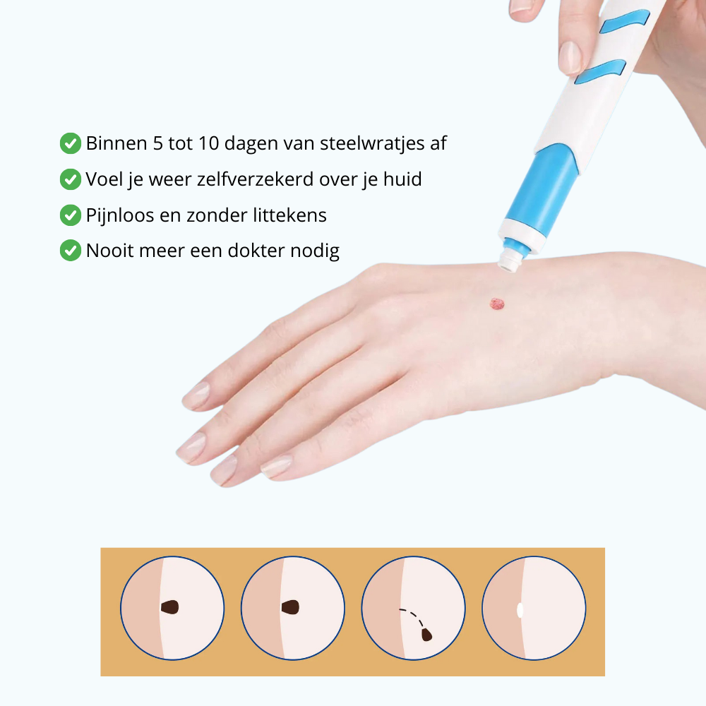 TagFree™ Kit | Voor iedereen die zich onzeker voelt over steelwratjes