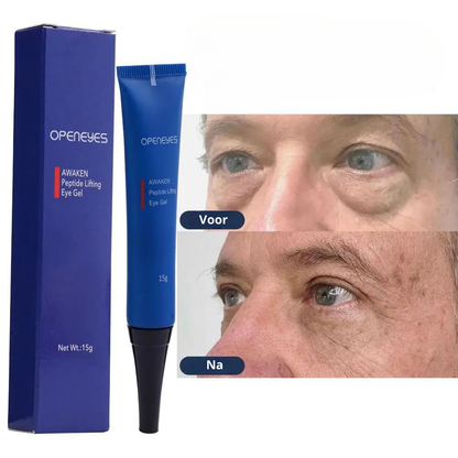 OpenEyes™ | Frisse, uitgeruste ogen in 30 seconden per dag | 1+1 gratis