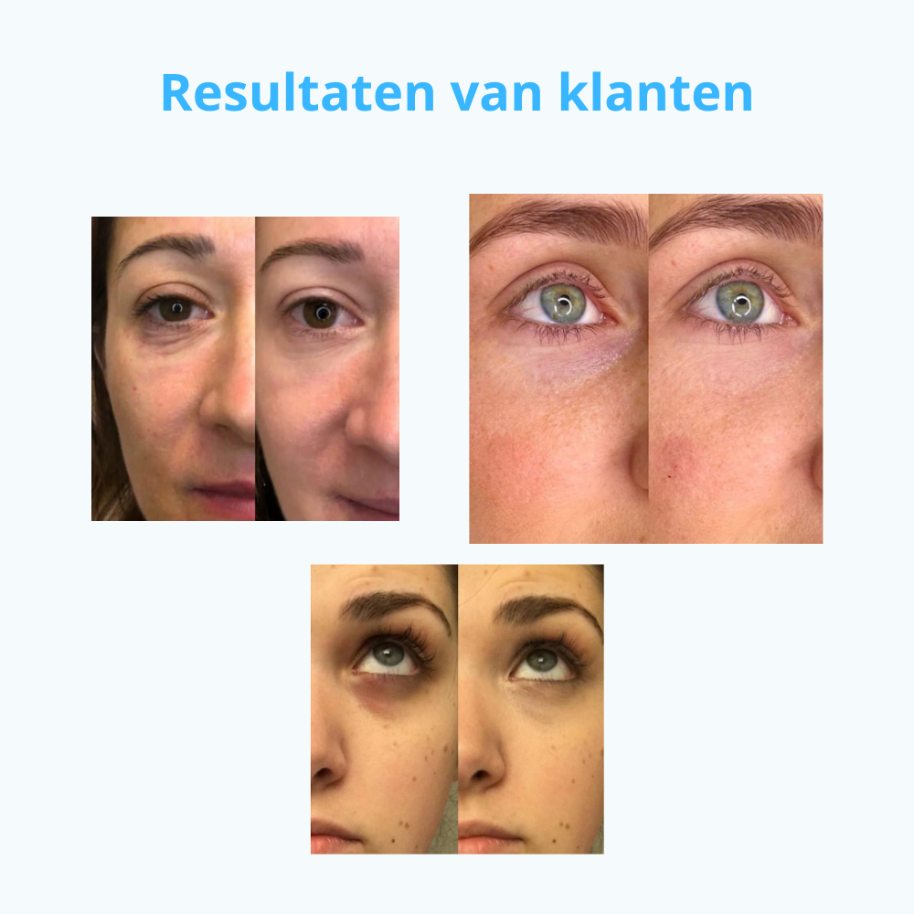 Niverno Eyepatches | Zie er jong en uitgerust uit | 3+2 gratis