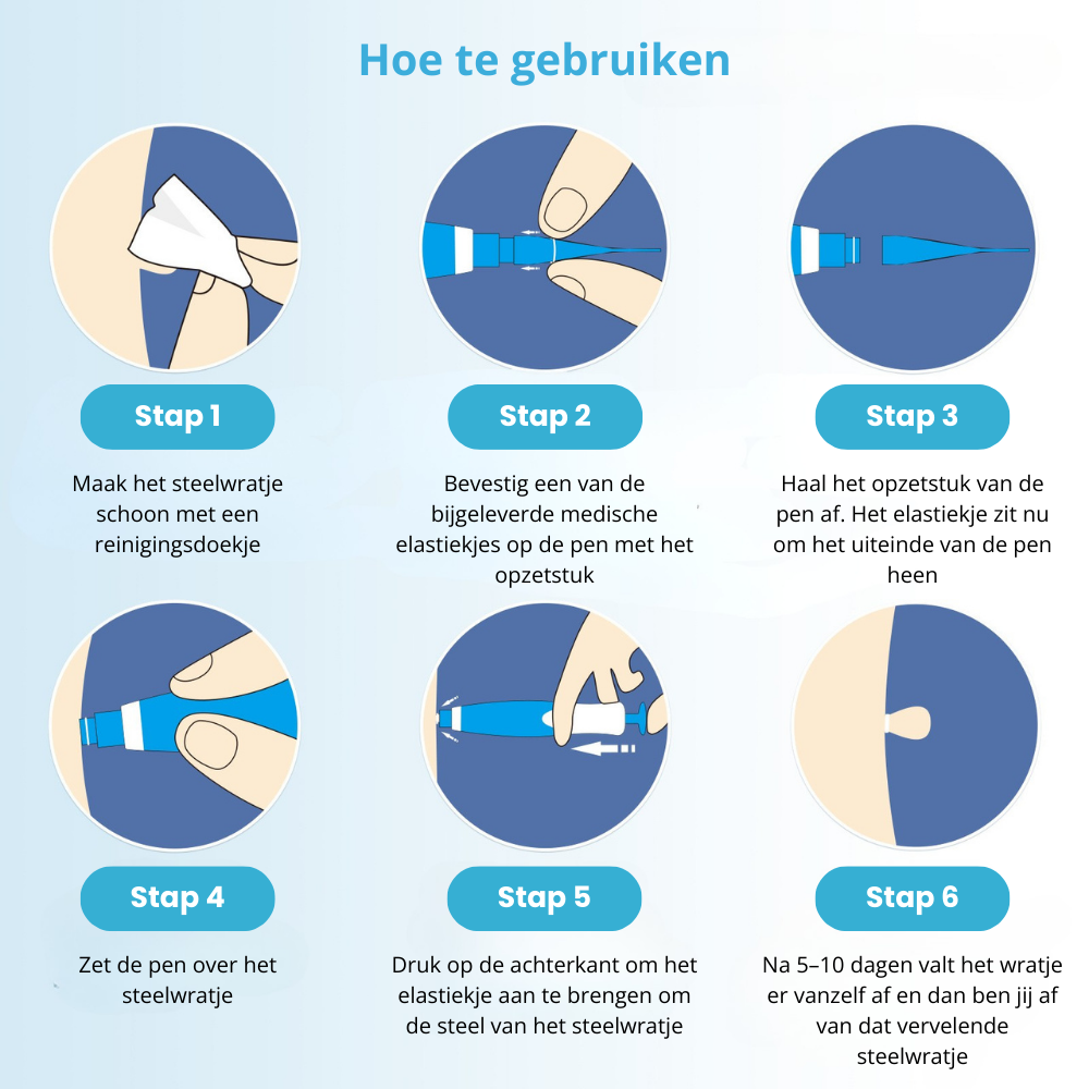 TagFree™ Kit | Voor iedereen die zich onzeker voelt over steelwratjes