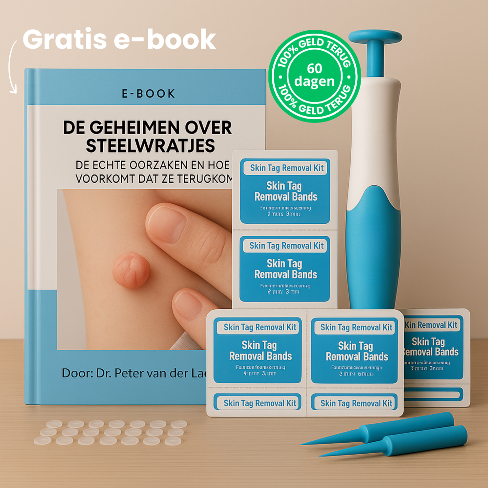 TagPen™ Kit | Verwijder steelwratjes veilig en gemakkelijk thuis | 50% korting