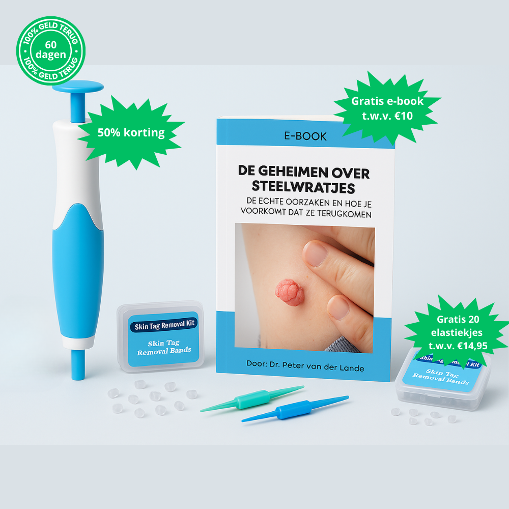 TagPen™ HomeKit | Verwijder steelwratjes veilig en gemakkelijk thuis | 50% korting